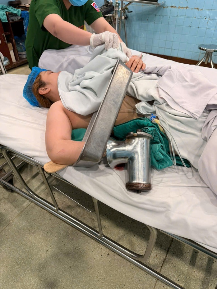 Clip b&aacute;c sĩ th&aacute;o rời m&aacute;y xay thịt để cứu b&agrave;n tay bệnh nh&acirc;n - Ảnh 2.