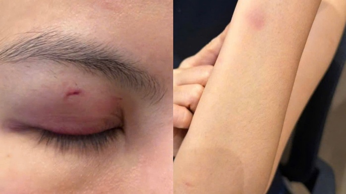 C&ocirc;ng an phường S&agrave;i G&ograve;n x&aacute;c minh vụ ca sĩ Trung Qu&acirc;n Idol đ&aacute;nh phụ nữ - Ảnh 1.