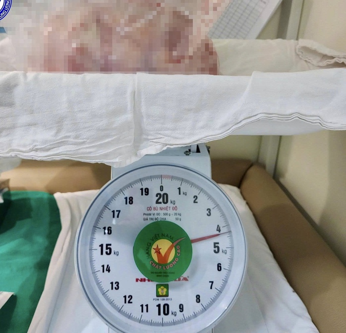 B&eacute; g&aacute;i 14 tuổi mang khối u buồng trứng hơn 4kg, gia đ&igrave;nh tưởng tăng c&acirc;n  - Ảnh 2.