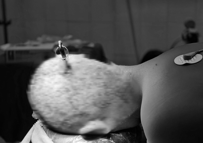 Hai học sinh nhập viện v&igrave; tai nạn học đường từ tr&ograve; đ&ugrave;a nghịch - Ảnh 1.