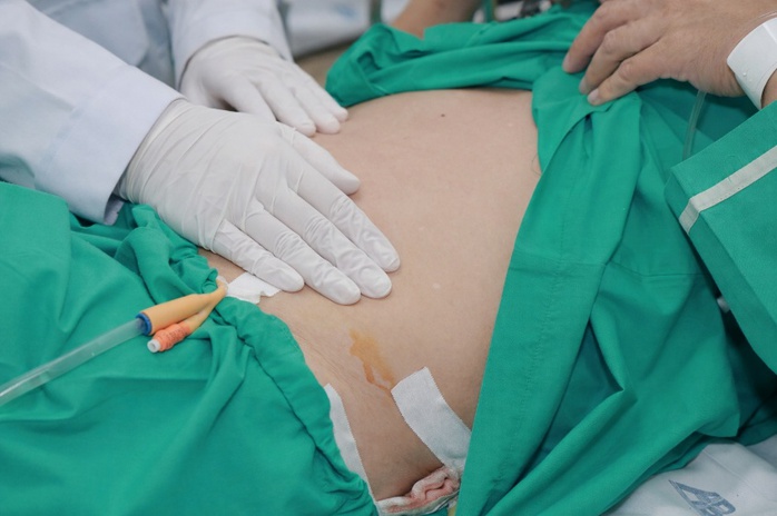 Người đ&agrave;n &ocirc;ng cấp cứu v&igrave; tin v&agrave;o &ldquo;thuốc tan sỏi&rdquo; tr&ecirc;n mạng - Ảnh 3.