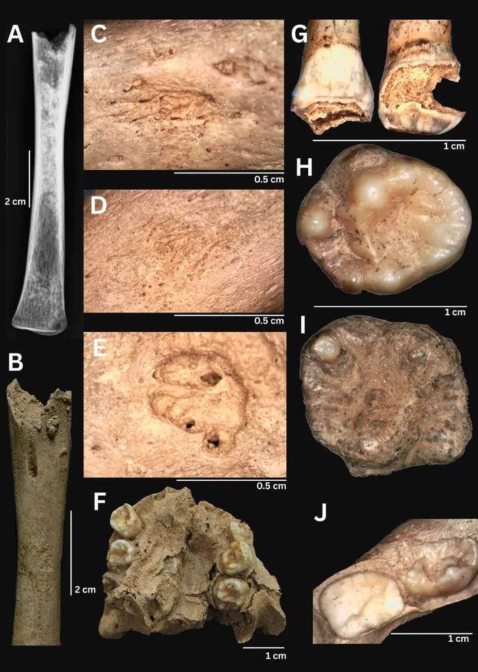 Nghi&ecirc;n cứu quốc tế h&eacute; lộ bất ngờ về h&agrave;i cốt 4.000 năm ở Việt Nam - Ảnh 2.