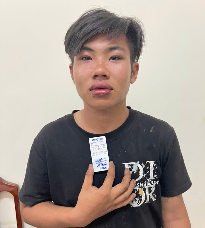 Đ&acirc;m bạn nhậu nguy kịch ở Đồng Nai: Hậu quả nghi&ecirc;m trọng từ M&acirc;u thuẫn x&atilde; hội - Ảnh 1.