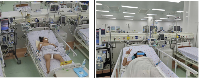 Li&ecirc;n tiếp trẻ nguy kịch v&igrave; sốt xuất huyết Dengue nặng, c&oacute; ca suy gan cấp - Ảnh 1.