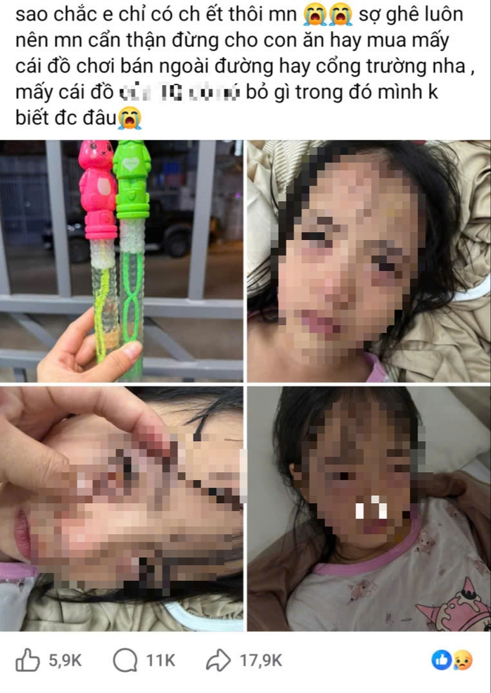 B&eacute; g&aacute;i 5 tuổi bị vi&ecirc;m kết mạc do đồ chơi thổi bong b&oacute;ng x&agrave; ph&ograve;ng - Ảnh 1.