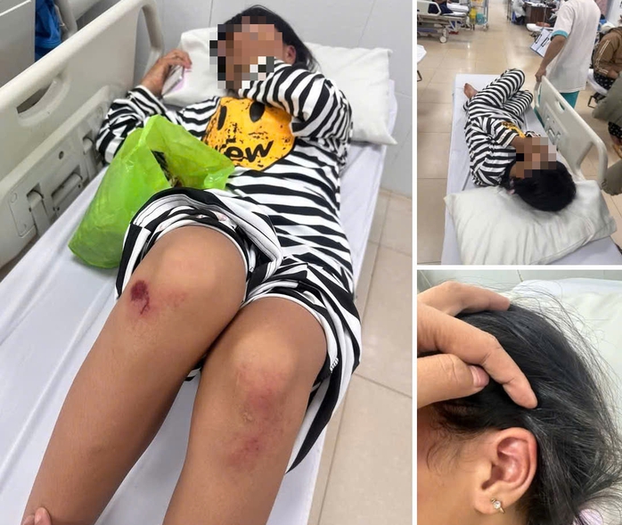 Nữ sinh lớp 6 bị đ&aacute;nh hội đồng ở Đắk Lắk: Vụ việc g&acirc;y sốc trong trường học - Ảnh 1.