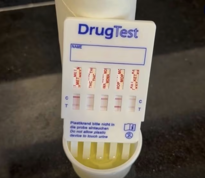 Nhiều phương pháp xét nghiệm ma túy, nhưng test nhanh chỉ mang tính sàng lọc - Ảnh 1.