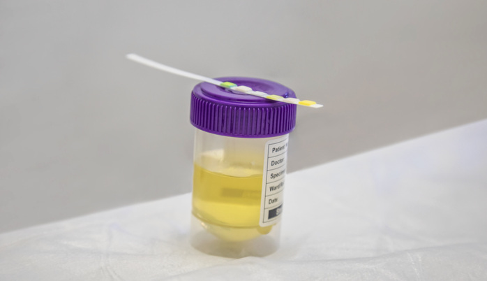 Nhiều phương pháp xét nghiệm ma túy, nhưng test nhanh chỉ mang tính sàng lọc - Ảnh 2.