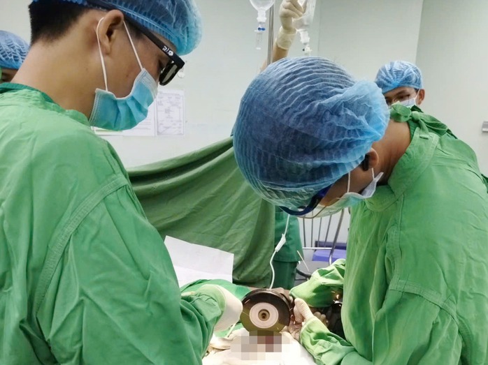 Người đàn ông ở An Giang gặp nạn vì “nâng cấp” dương vật, bác sĩ chỉ ra những nguy cơ - Ảnh 1.