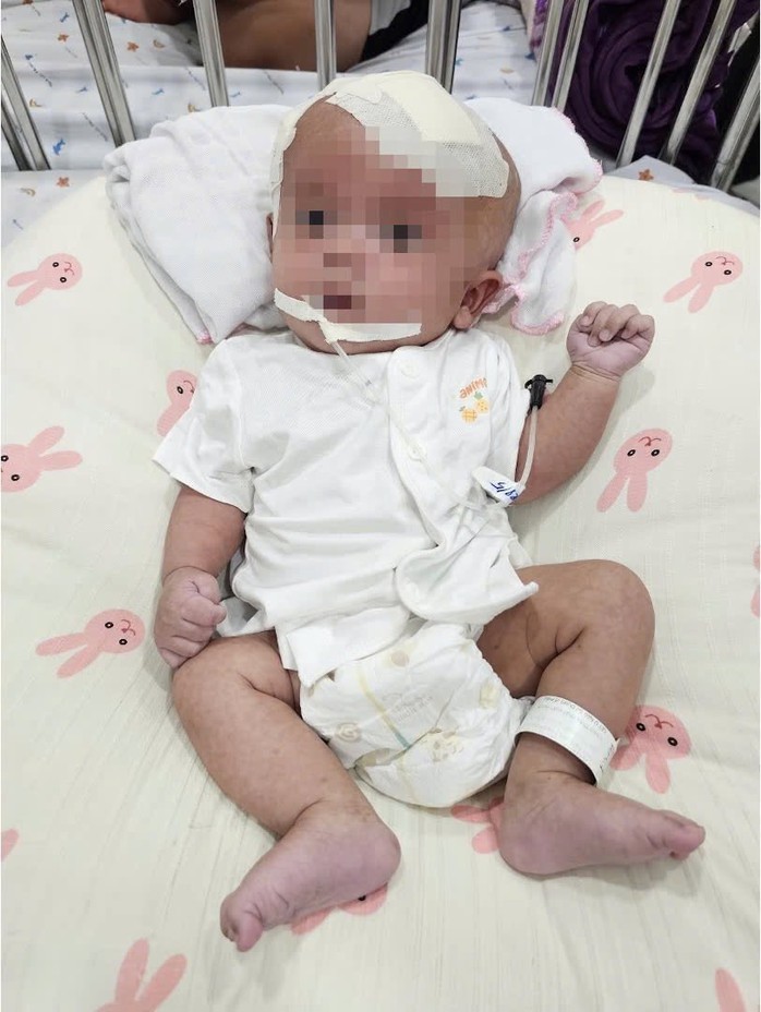 Khối u to 8cm trong n&atilde;o b&eacute; g&aacute;i được b&aacute;c sĩ phẫu thuật th&agrave;nh c&ocirc;ng - Ảnh 2.
