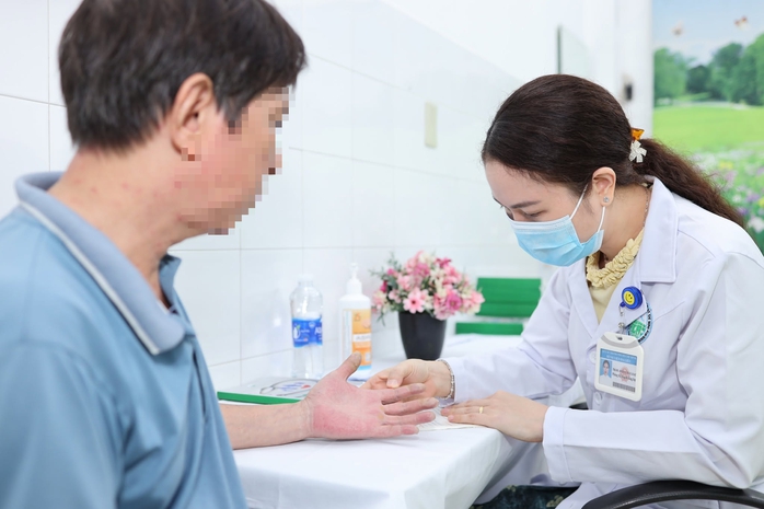 Tư vấn viêm da cơ điạ miễn phí - Ảnh 1.