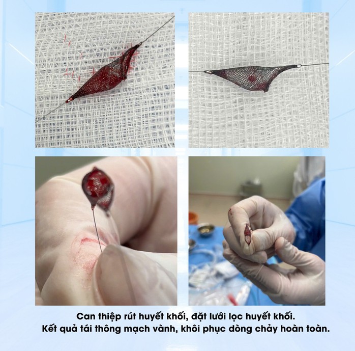 Bệnh viện Vĩnh Đức cứu sống t&agrave;i xế bị ngưng tim, ngưng thở - Ảnh 2.
