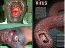 Ebola có lây qua đường tình dục? Ebola có lây qua đường tình dục?