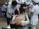 Dùng xăng tẩy nhựa đường, cả gia đình 3 người bỏng nặng Dùng xăng tẩy nhựa đường, cả gia đình 3 người bỏng nặng