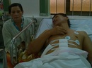 Cứu sống bệnh nhân bị con đâm thủng gan, thận Cứu sống bệnh nhân bị con đâm thủng gan, thận