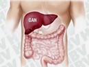 Bệnh nhân viêm gan C chỉ còn chi trả nửa tiền thuốc Bệnh nhân viêm gan C chỉ còn chi trả nửa tiền thuốc