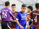 U23 Việt Nam đi bệnh viện đo điện tâm đồ U23 Việt Nam đi bệnh viện đo điện tâm đồ