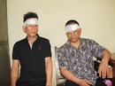 Trộm chó mang theo kiếm búa, bị dân đánh trọng thương Trộm chó mang theo kiếm búa, bị dân đánh trọng thương