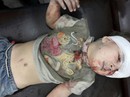 Cậu bé Syria chỉ òa khóc khi gặp cha mẹ Cậu bé Syria chỉ òa khóc khi gặp cha mẹ