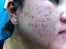 Mỹ phẩm dỏm tàn phá dung nhan Mỹ phẩm dỏm tàn phá dung nhan