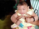Bé gái 4 tháng tuổi ở Đắk Lắk bị dị tật do virus Zika Bé gái 4 tháng tuổi ở Đắk Lắk bị dị tật do virus Zika