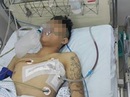 Thanh niên 18 tuổi bị đâm thấu ngực nghi do ghen tuông Thanh niên 18 tuổi bị đâm thấu ngực nghi do ghen tuông