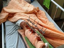 Nam thanh niên bị chém đứt lìa chân ở Gia Lai Nam thanh niên bị chém đứt lìa chân ở Gia Lai