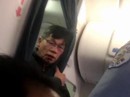 Bác sĩ gốc Việt bắt đầu đưa United Airlines ra tòa Bác sĩ gốc Việt bắt đầu đưa United Airlines ra tòa