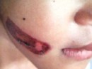 Sự thật vụ bé gái bị cha đẻ và mẹ kế bạo hành dã man Sự thật vụ bé gái bị cha đẻ và mẹ kế bạo hành dã man