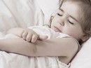 Da bé mong manh, dễ mẩn ngứa, làm sao? Da bé mong manh, dễ mẩn ngứa, làm sao?