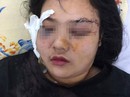 Cô gái trẻ bị nhóm côn đồ đâm chém dã man Cô gái trẻ bị nhóm côn đồ đâm chém dã man