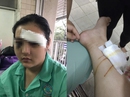 Vụ thiếu nữ bị đâm chém dã man: Người nhà bị đe dọa cắt chân Vụ thiếu nữ bị đâm chém dã man: Người nhà bị đe dọa cắt chân