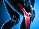 Tập luyện lấy lại ngoại hình, cô gái bị thoái hóa khớp Tập luyện lấy lại ngoại hình, cô gái bị thoái hóa khớp