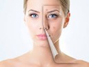 Da mụn, có cần "né" mỹ phẩm? Da mụn, có cần "né" mỹ phẩm?