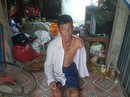 Khó tin với người đàn ông 10 lần bị tai nạn giao thông Khó tin với người đàn ông 10 lần bị tai nạn giao thông