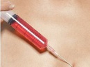 Ngày mai xử vụ thuê người tiêm máu có HIV vào con tình địch Ngày mai xử vụ thuê người tiêm máu có HIV vào con tình địch