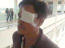 Tín dụng đen bủa vây dân nghèo: Kẻ tự tử, người bị đâm mù mắt Tín dụng đen bủa vây dân nghèo: Kẻ tự tử, người bị đâm mù mắt