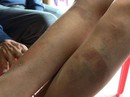 Bạo hành trẻ em, vì đâu nên nỗi? Bạo hành trẻ em, vì đâu nên nỗi?