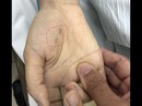 Chẩn đoán nhầm bệnh thú cưng, nữ bác sĩ trẻ tử vong do chó cắn Chẩn đoán nhầm bệnh thú cưng, nữ bác sĩ trẻ tử vong do chó cắn