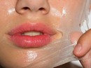 Lạm dụng lột da mặt làm trắng, cẩn thận rước họa Lạm dụng lột da mặt làm trắng, cẩn thận rước họa