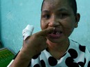 Vụ hành hạ dã man người làm công: Cứ "chơi đá" là ra tay tra tấn Vụ hành hạ dã man người làm công: Cứ "chơi đá" là ra tay tra tấn