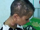 Điều tra, xử lý nghiêm vụ chủ bạo hành dã man người làm thuê Điều tra, xử lý nghiêm vụ chủ bạo hành dã man người làm thuê