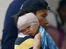 Philippines: Hạn chế đốt pháo nhưng vẫn gần 200 người bị thương Philippines: Hạn chế đốt pháo nhưng vẫn gần 200 người bị thương