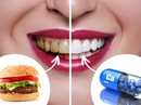 Mẹo chữa nghiến răng ban đêm Mẹo chữa nghiến răng ban đêm