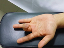 Ai dễ mắc bệnh lý ngón tay lò xo? Ai dễ mắc bệnh lý ngón tay lò xo?