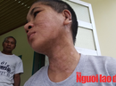 Vụ Nga "vọc" tra tấn dã man: Y Nhiêu khai gì với công an? Vụ Nga "vọc" tra tấn dã man: Y Nhiêu khai gì với công an?