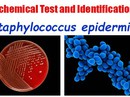 Siêu khuẩn kháng thuốc lan rộng trong các bệnh viện trên thế giới Siêu khuẩn kháng thuốc lan rộng trong các bệnh viện trên thế giới