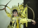 Té ngã vỡ mạch máu não, nghệ sĩ Thanh Thế nguy kịch Té ngã vỡ mạch máu não, nghệ sĩ Thanh Thế nguy kịch