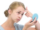 4 bí quyết chống lại mụn trong mùa hè 4 bí quyết chống lại mụn trong mùa hè