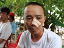 Vụ nhóm thanh niên đến nhà truy sát 3 cha con: Kẻ đâm chết người bị bắt lúc 2 giờ sáng Vụ nhóm thanh niên đến nhà truy sát 3 cha con: Kẻ đâm chết người bị bắt lúc 2 giờ sáng